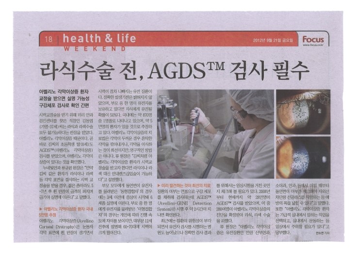 [신문] Focus - 라식수술 전, AGDS 검사 필수 썸네일 이미지